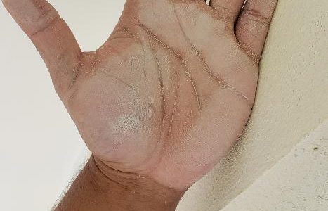 Chalking on Stucco Surface