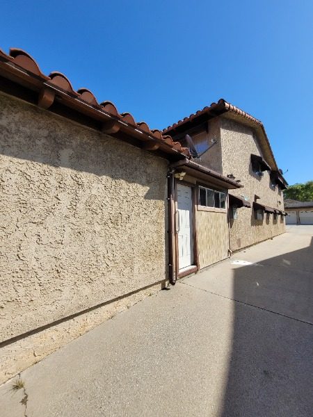 Side (Before) Preview Image 7