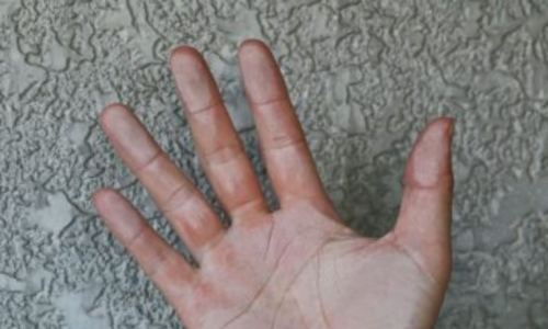 sign you need painting chalky residue